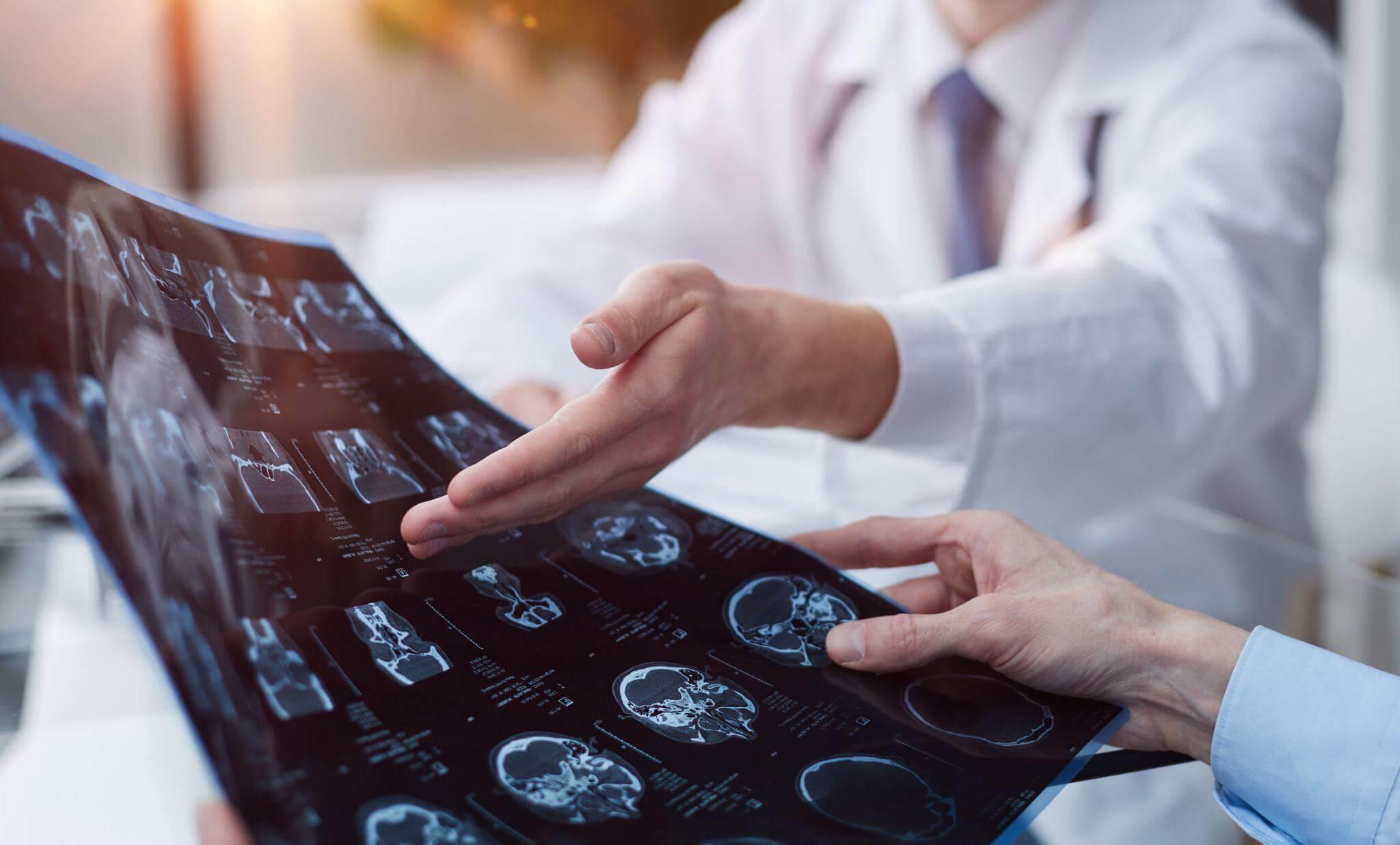 Doctors reviewing a traumatic brain injury